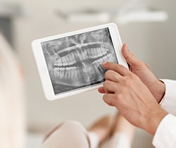 Panoramic digital dental x-rays