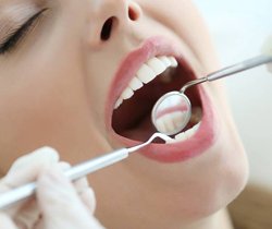 woman at dental cleaning