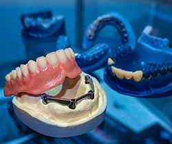 implant dentures on table in State College