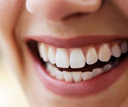 Closeup of healthy teeth and gums after antibiotic therapy