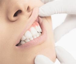 Dentist examining gums after periodontal therapy