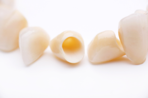 dental crowns