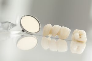 Dental crowns support and beautify failing teeth.